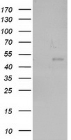 HEK293T cells were transfected with the pCMV6-ENTRY control (Left lane) or pCMV6-ENTRY NEU2 (Right lane) cDNA for 48 hrs and lysed. Equivalent amounts of cell lysates (5 ug per lane) were separated by SDS-PAGE and immunoblotted with anti-NEU2.