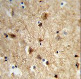 Formalin-fixed and paraffin-embedded human brain tissue reacted with NEURL Antibody , which was peroxidase-conjugated to the secondary antibody, followed by DAB staining. This data demonstrates the use of this antibody for immunohistochemistry; clinical relevance has not been evaluated.