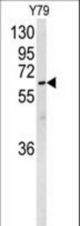 Western blot of NEURL Antibody in Y79 cell line lysates (35 ug/lane). NEURL (arrow) was detected using the purified antibody.