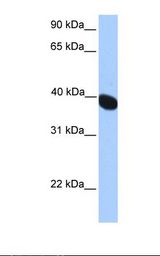 Fetal muscle lysate. Antibody concentration: 1.0 ug/ml. Gel concentration: 12%.
