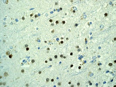 IHC of paraffin-embedded human brain tissue using anti-NeuroD2 antibody.