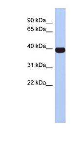 NEUROD4 antibody LS-C109660 Western blot of Fetal Spleen lysate.