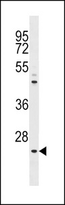 The anti-NeuroG1 N-term antibody is used in Western blot to detect NeuroG1 in A375 cell lysate.