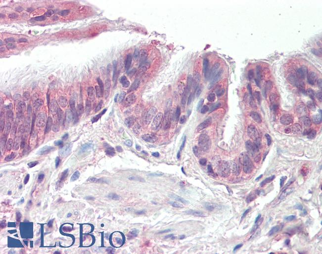 Anti-PSMB3 antibody IHC staining of human lung, respiratory epithelium. Immunohistochemistry of formalin-fixed, paraffin-embedded tissue after heat-induced antigen retrieval. Antibody LS-B9527 concentration 10 ug/ml.