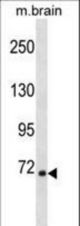 Mouse Rps6ka1 Antibody western blot of mouse brain tissue lysates (35 ug/lane). The Rps6ka1 antibody detected the Rps6ka1 protein (arrow).