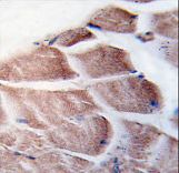 Formalin-fixed and paraffin-embedded human skeletal muscle tissue reacted with RSK3 antibody , which was peroxidase-conjugated to the secondary antibody, followed by DAB staining. This data demonstrates the use of this antibody for immunohistochemistry; clinical relevance has not been evaluated.