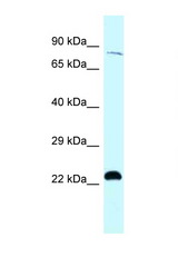 RPS6KA4 / MSK2 antibody LS-C145909 Western blot of Jurkat Cell lysate. Antibody concentration 1 ug/ml.