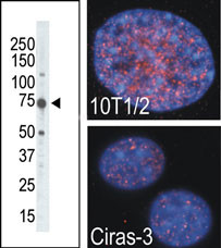 The anti-MSK2 antibody is used in Western blot to detect MSK2 in placenta tissue lysate. Indirect immunofluorescence analysis showed that MSK2 is predominantly localized in the nucleus of parental (10T1/2) and oncogene-transformed (Ciras-3) mouse fibroblasts. Cells were co-stained with DAPI to visualize nucleus compartment. Data is kindly provided by B. Drobic and Dr. J. Davie from University of Manitoba (Winnipeg, Canada).