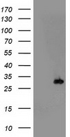 HEK293T cells were transfected with the pCMV6-ENTRY control (Left lane) or pCMV6-ENTRY PSMB4 (Right lane) cDNA for 48 hrs and lysed. Equivalent amounts of cell lysates (5 ug per lane) were separated by SDS-PAGE and immunoblotted with anti-PSMB4.