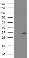 HEK293T cells were transfected with the pCMV6-ENTRY control (Left lane) or pCMV6-ENTRY PSMB4 (Right lane) cDNA for 48 hrs and lysed. Equivalent amounts of cell lysates (5 ug per lane) were separated by SDS-PAGE and immunoblotted with anti-PSMB4.