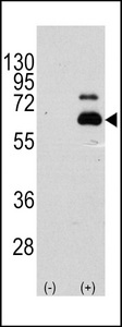 Western blot of RPS6KB1 (arrow) using rabbit polyclonal RPS6KB1 Antibody (S404) (RB11396). 293 cell lysates (2 ug/lane) either nontransfected (Lane 1) or transiently transfected with the RPS6KB1 gene (Lane 2) (Origene Technologies).