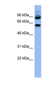 RPS6KB1 / S6K antibody LS-C107580 Western blot of HeLa lysate.