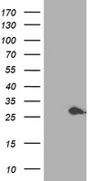 HEK293T cells were transfected with the pCMV6-ENTRY control (Left lane) or pCMV6-ENTRY PSMB4 (Right lane) cDNA for 48 hrs and lysed. Equivalent amounts of cell lysates (5 ug per lane) were separated by SDS-PAGE and immunoblotted with anti-PSMB4.