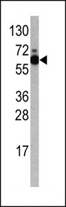 Western blot of anti-RPS6KB1 Antibody antibody in Jurkat cell line lysates (35 ug/lane). RPS6KB1 Antibody )(arrow) was detected using the purified antibody.