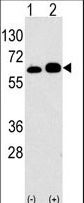 Western blot of anti-RPS6KB1 Antibody antibody in 293 cell line lysates transiently transfected with the RPS6KB1 gene (2 ug/lane). RPS6KB1(arrow) was detected using the purified antibody.