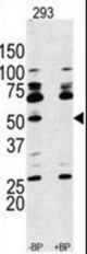 Western blot of anti-RPS6KB1 Antibody antibody pre-incubated with and without blocking peptide (BP#NULL) in 293 cell line lysate. RPS6KB1 Antibody (arrow) was detected using the purified antibody.