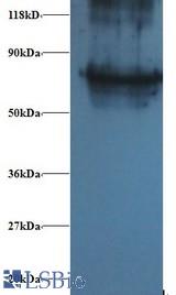 Western blot of Proteasome subunit beta type-4 Antibody at 2 ug/ml + EC109 whole cell lysate at 20 ug. Secondary: Goat polyclonal to Rabbit IgG at 1:15000 dilution. Predicted band size: 29 kDa. Observed band size: 75 kDa.
