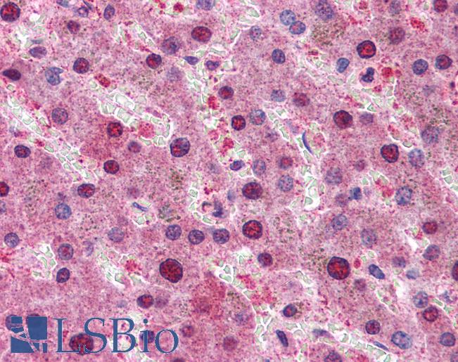 Anti-RPS6KB1 / S6K antibody IHC of human liver. Immunohistochemistry of formalin-fixed, paraffin-embedded tissue after heat-induced antigen retrieval. Antibody LS-B4439 concentration 3.75 ug/ml.
