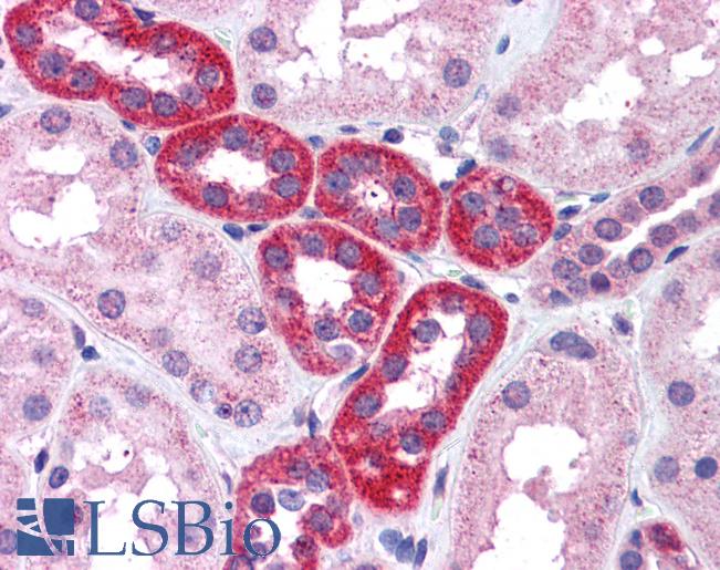 Anti-RPS6KB1 / S6K antibody IHC of human kidney. Immunohistochemistry of formalin-fixed, paraffin-embedded tissue after heat-induced antigen retrieval. Antibody LS-B4439 concentration 3.75 ug/ml.