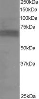 RPS6KB1 antibody staining (0.2 ug/ml) of Human Muscle lysate (RIPA buffer, 35g total protein per lane). Primary incubated for 1 hour. Detected by Western blot of chemiluminescence.