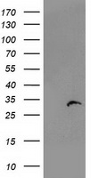 HEK293T cells were transfected with the pCMV6-ENTRY control (Left lane) or pCMV6-ENTRY PSMB4 (Right lane) cDNA for 48 hrs and lysed. Equivalent amounts of cell lysates (5 ug per lane) were separated by SDS-PAGE and immunoblotted with anti-PSMB4.