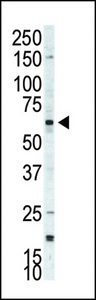 Western blot of anti-p70S6Kbeta antibody in A375 cell lysate. p70S6Kbeta (arrow) was detected using purified antibody. Secondary HRP-anti-rabbit was used for signal visualization with chemiluminescence.
