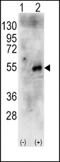 Western blot of RPS6KB2 (arrow) using rabbit polyclonal RPS6KB2 Antibody (RB11689). 293 cell lysates (2 ug/lane) either nontransfected (Lane 1) or transiently transfected with the human RPS6KB2 gene (Lane 2) (Origene Technologies).