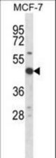 Mouse Rps6kb2 Antibody western blot of MCF-7 cell line lysates (35 ug/lane). The Rps6kb2 antibody detected the Rps6kb2 protein (arrow).