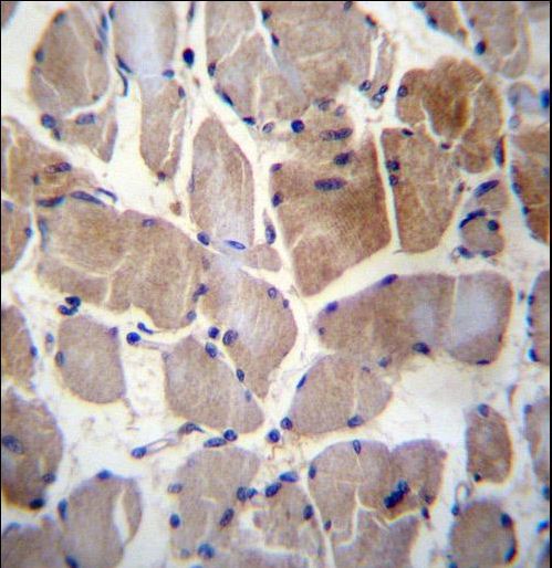RPS6KC1 Antibody immunohistochemistry of formalin-fixed and paraffin-embedded human skeletal muscle followed by peroxidase-conjugated secondary antibody and DAB staining.
