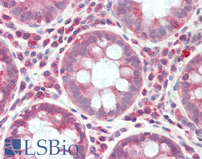 Anti-RPS6KC1 antibody IHC staining of human colon. Immunohistochemistry of formalin-fixed, paraffin-embedded tissue after heat-induced antigen retrieval. Antibody LS-B9979 concentration 10 ug/ml.