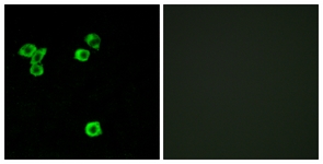 Immunofluorescence of LOVO cells, using RPS6KC1 Antibody. The picture on the right is treated with the synthesized peptide.