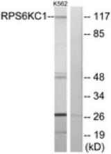 Western blot of extracts from K562 cells, using RPS6KC1 Antibody. The lane on the right is treated with the synthesized peptide.