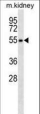 RPS6KL1 Antibody western blot of mouse kidney tissue lysates (35 ug/lane). The RPS6KL1 antibody detected the RPS6KL1 protein (arrow).
