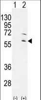 Western blot of RPS6KL1 (arrow) using rabbit polyclonal RPS6KL1 Antibody. 293 cell lysates (2 ug/lane) either nontransfected (Lane 1) or transiently transfected (Lane 2) with the RPS6KL1 gene.