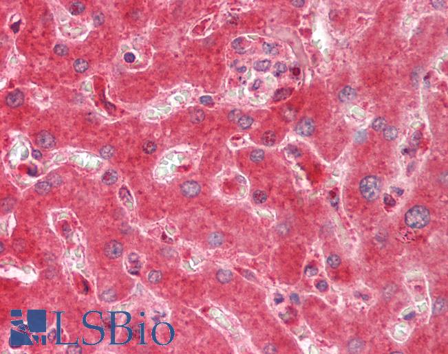 Human Liver: Formalin-Fixed, Paraffin-Embedded (FFPE)