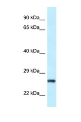 RPS9 antibody western blot of HeLa cell lysate. Antibody concentration 1 ug/ml.