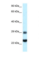 RPS9 antibody LS-C145472 Western blot of HepG2 Cell lysate. Antibody concentration 1 ug/ml.