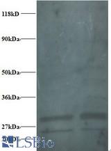 Western blot of 40S ribosomal protein S9 antibody at 2 ug/ml. Lane 1:293T whole cell lysate. Lane 2: EC109 whole cell lysate. Secondary: Goat polyclonal to Rabbit IgG at 1:15000 dilution. Predicted band size: 21 kDa. Observed band size: 26 kDa Additional bands at: 28 kDa. We are unsure as to the identity of these extra bands. 40S ribosomal protein S9 contains a number of potential phosphorylation and acetylation sites (SwissProt) which may explain its migration at a higher molecular weight than predicted.