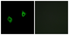 Immunofluorescence of A549 cells, using RPS9 Antibody. The picture on the right is treated with the synthesized peptide.