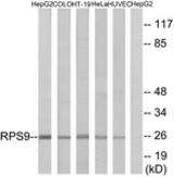 Western blot of extracts from HepG2/COLO/HT-29/HeLa/HUVEC cells, using RPS9 Antibody. The lane on the right is treated with the synthesized peptide.