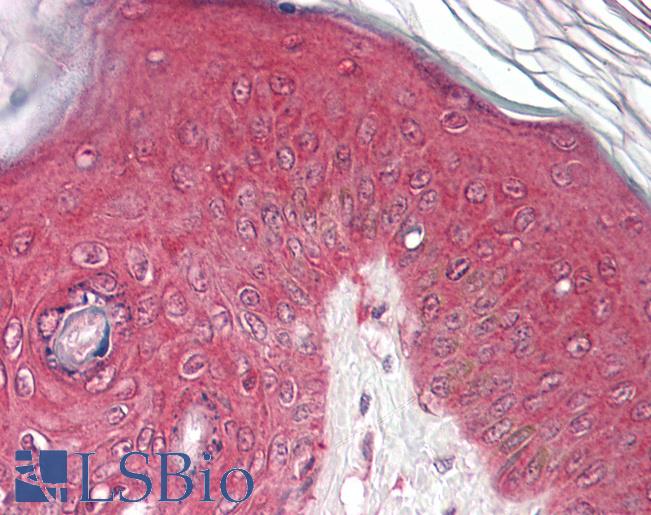 Anti-PSMB4 antibody IHC of human skin. Immunohistochemistry of formalin-fixed, paraffin-embedded tissue after heat-induced antigen retrieval. Antibody LS-B8342 dilution 3.75 ug/ml.