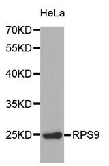 Western blot analysis of extracts of HeLa cell line, using RPS9 antibody.