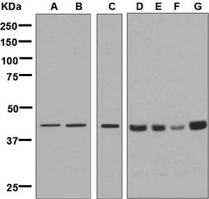 Western blot analysis on (A) K562, (B) HeLa, (C) HepG2, (D) C6, (E) RAW 264.7, (F) PC-12, and (G) NIH/3T3 cell lysates using anti-RPSA / Laminin Receptor antibody.