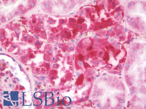 Anti-RPSA / Laminin Receptor antibody IHC staining of human kidney. Immunohistochemistry of formalin-fixed, paraffin-embedded tissue after heat-induced antigen retrieval. Antibody LS-B10178 concentration 10 ug/ml.