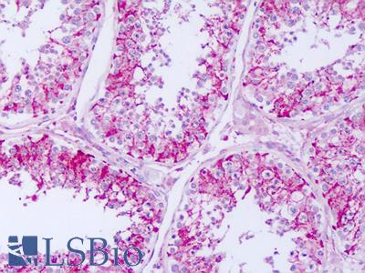 Anti-RPTN / Repetin antibody IHC of human testis. Immunohistochemistry of formalin-fixed, paraffin-embedded tissue after heat-induced antigen retrieval. Antibody LS-B8279 dilution 5-10 ug/ml.