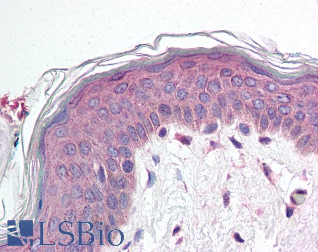 Anti-RPTN / Repetin antibody IHC of human skin. Immunohistochemistry of formalin-fixed, paraffin-embedded tissue after heat-induced antigen retrieval. Antibody LS-B17 concentration 5 ug/ml.