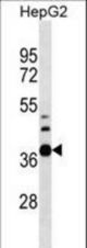 RPUSD1 Antibody western blot of HepG2 cell line lysates (35 ug/lane). The RPUSD1 antibody detected the RPUSD1 protein (arrow).