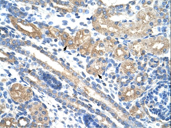 RPUSD2 antibody LS-C31260 was used in IHC to stain formalin-fixed, paraffin-embedded human kidney.