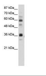 HepG2 Cell Lysate