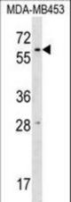 RPUSD2 Antibody western blot of MDA-MB453 cell line lysates (35 ug/lane). The RPUSD2 antibody detected the RPUSD2 protein (arrow).
